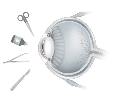 수술 및 약물 투여 형상 이미지