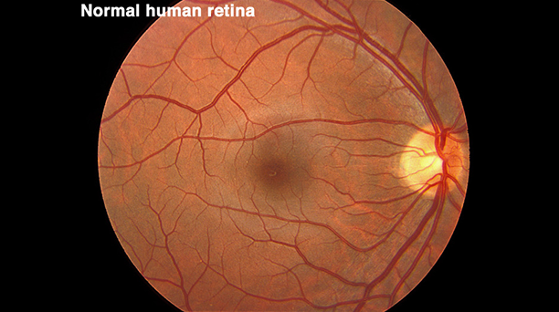 Normal Human retina 이미지