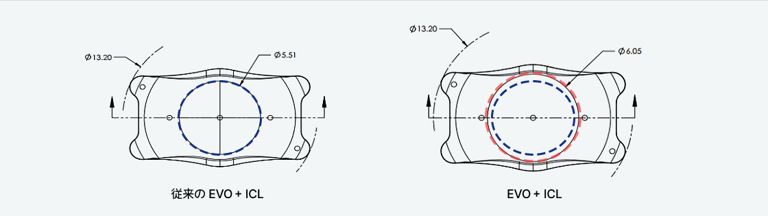 기존 아쿠아 ICL EVO＋ ICL 비교 이미지